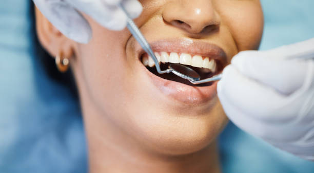 Best Emergency Wisdom Teeth Removal in West Tawakoni, TX
